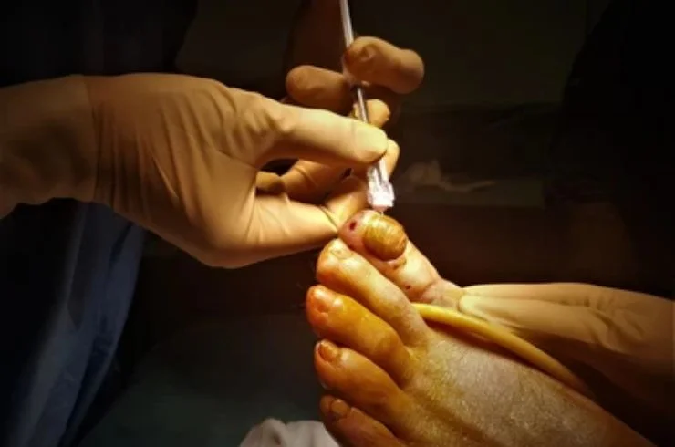 Nail Surgeries---01